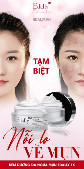 TẠM BIỆT NỖI LO VỀ MỤN VỚI KEM DƯỠNG DA NGỪA MỤN EDALLY EX 