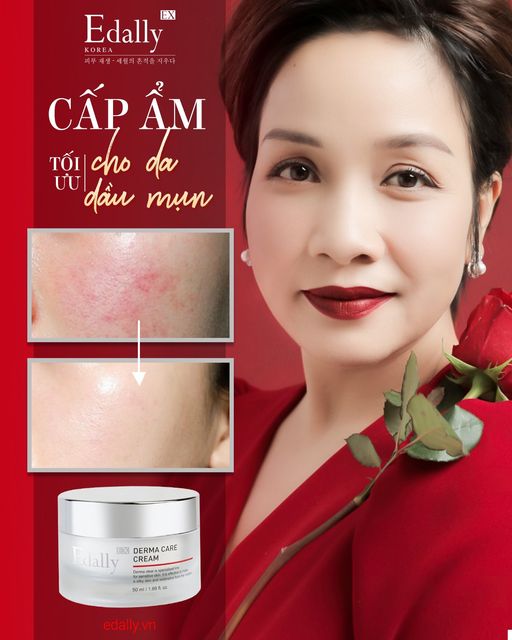 CẤP ẨM TỐI ƯU CHO LÀN DA DẦU MỤN