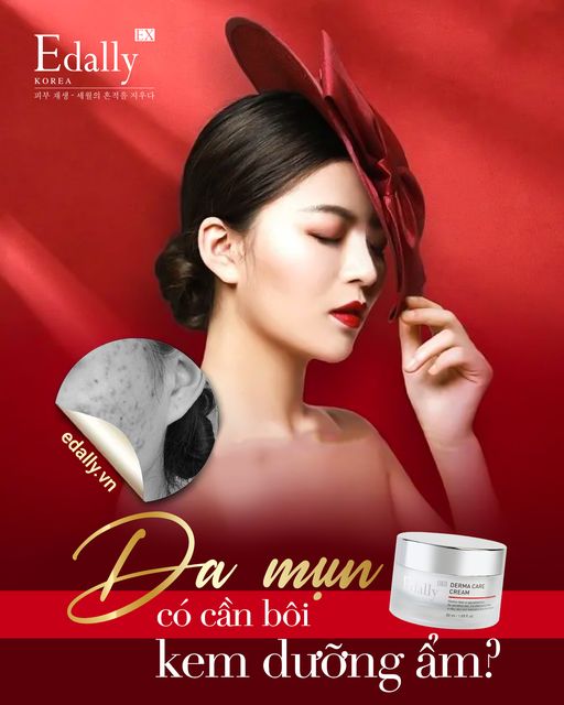 DA MỤN CÓ CẦN DÙNG KEM DƯỠNG ẨM?