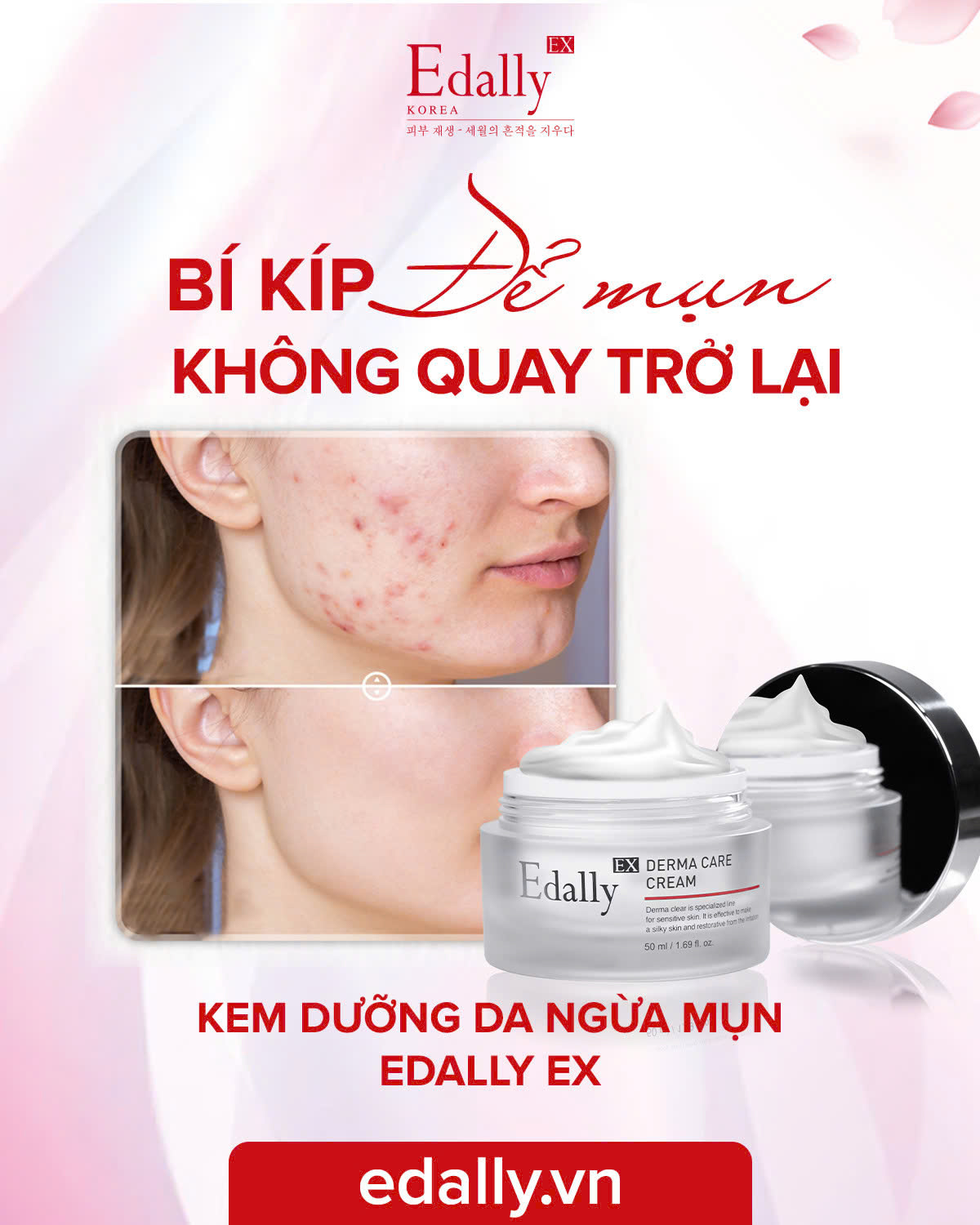 Mụn luôn là vấn đề đau đầu với chị em phụ nữ ở mọi lứa tuổi. 